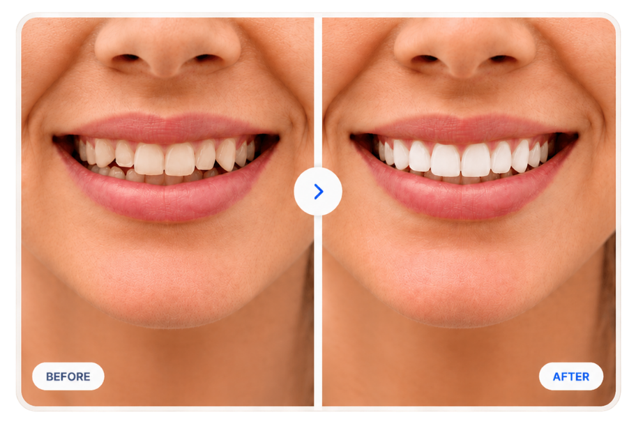 Before and After